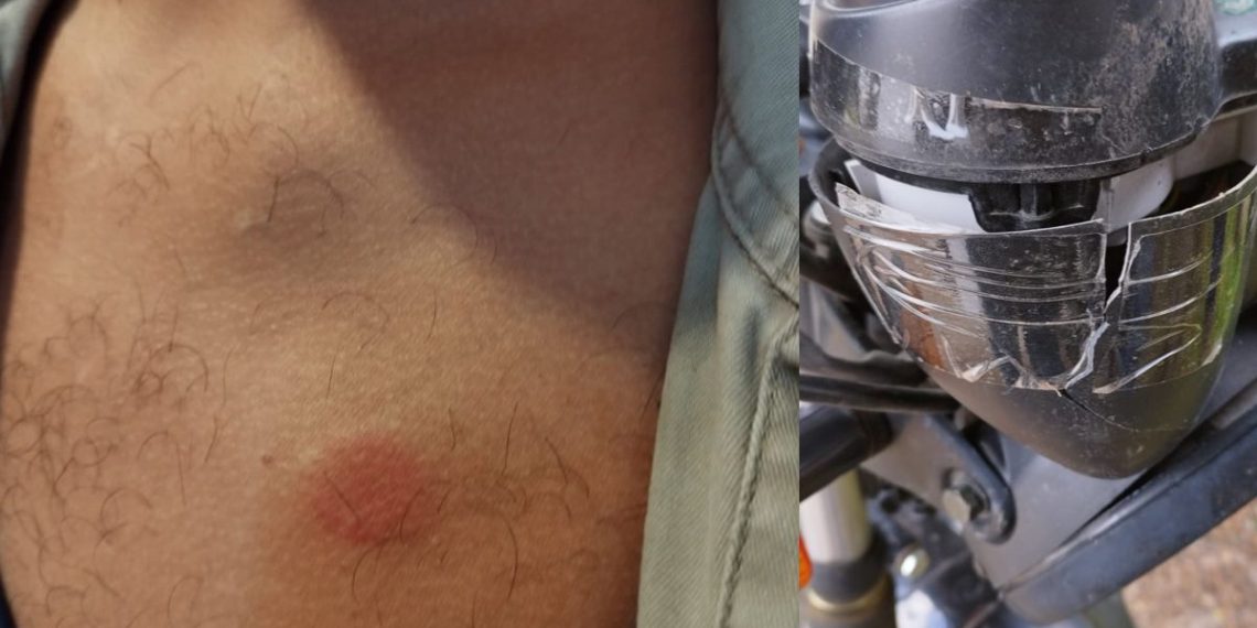 Unitán denunció que gremialistas «atacaron salvajemente» a un empleado que quiso ingresar a trabajar