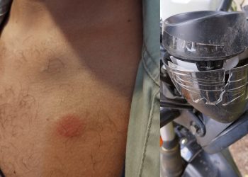 Unitán denunció que gremialistas «atacaron salvajemente» a un empleado que quiso ingresar a trabajar