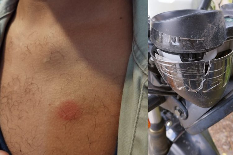 Unitán denunció que gremialistas «atacaron salvajemente» a un empleado que quiso ingresar a trabajar