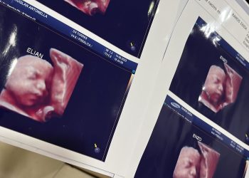 Madres descubrieron por las redes que «todas» tenían misma imagen en la ecografía