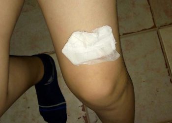 Bullying sin frenos en una escuela del barrio República Argentina