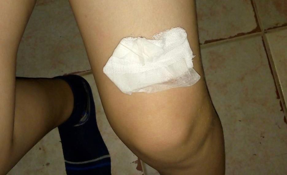 Bullying sin frenos en una escuela del barrio República Argentina