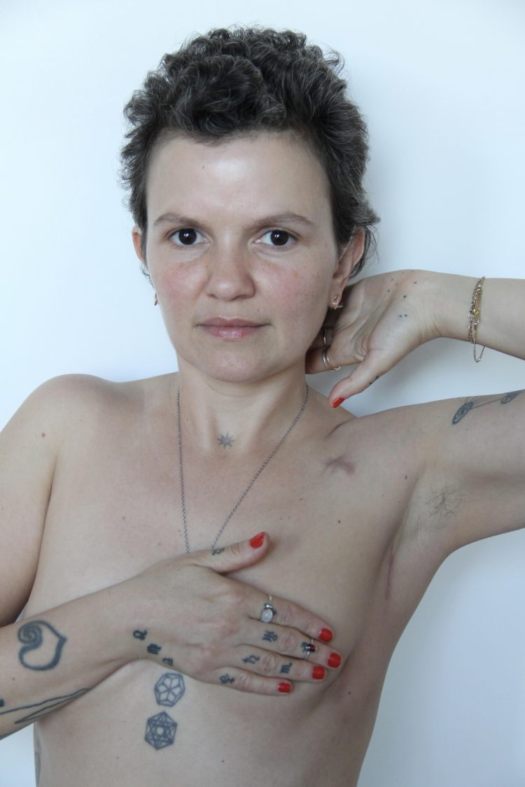 Superar un cáncer de mama contado en primera persona