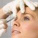 ¿Para qué sirve el bótox en la cara?