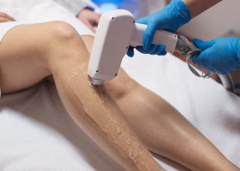 Adiós al afeitado: descubre los avances en depilación definitiva para hombres y mujeres