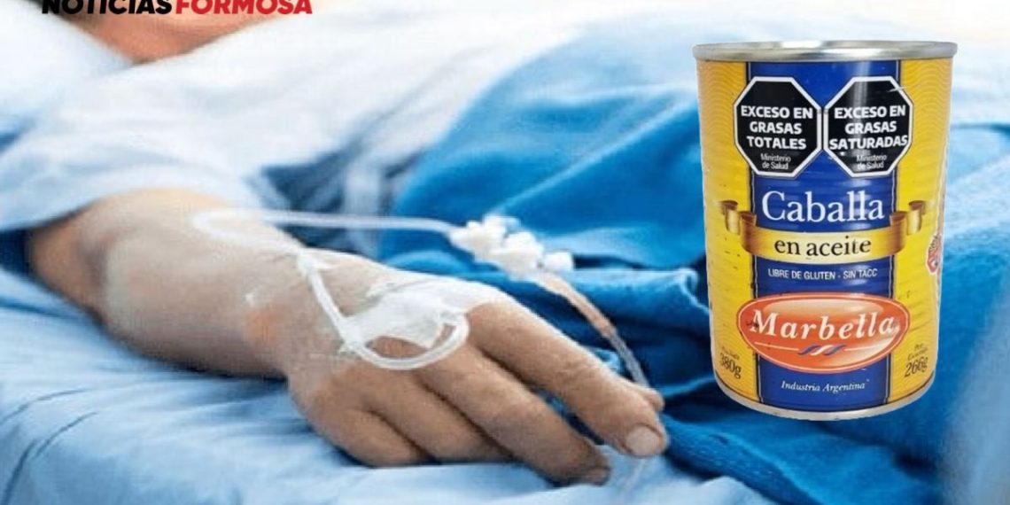 Confirman un caso de botulismo alimentario en Ingeniero Juárez. Qué es, cómo prevenirlo