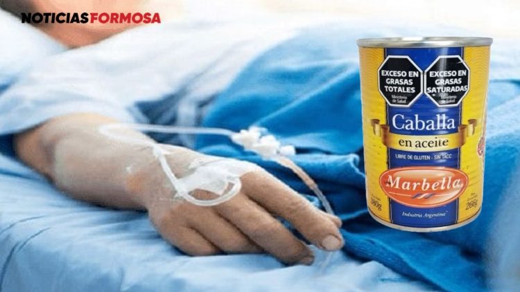 Confirman un caso de botulismo alimentario en Ingeniero Juárez. Qué es, cómo prevenirlo