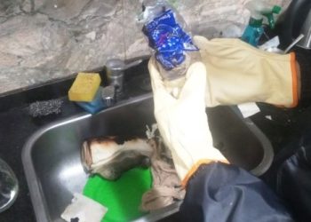 Se roció con alcohol, encendió la cocina y se prendió fuego gran parte del cuerpo, está internado grave