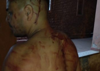 Asaltos a mano armada y robos en Alberdi, un argentino-paraguayo con negocios en el C5, una de las víctimas