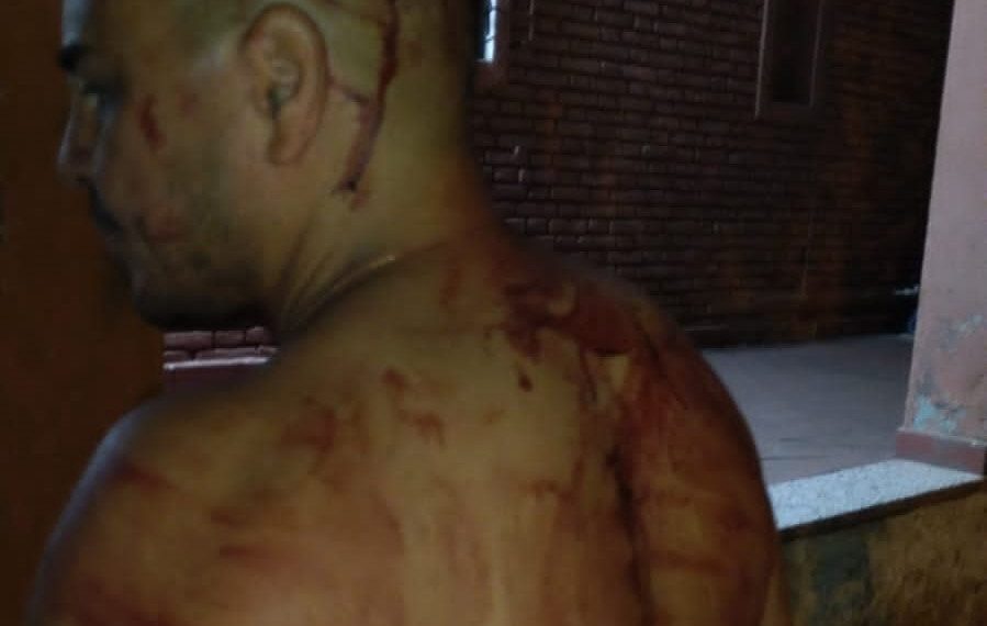 Asaltos a mano armada y robos en Alberdi, un argentino-paraguayo con negocios en el C5, una de las víctimas