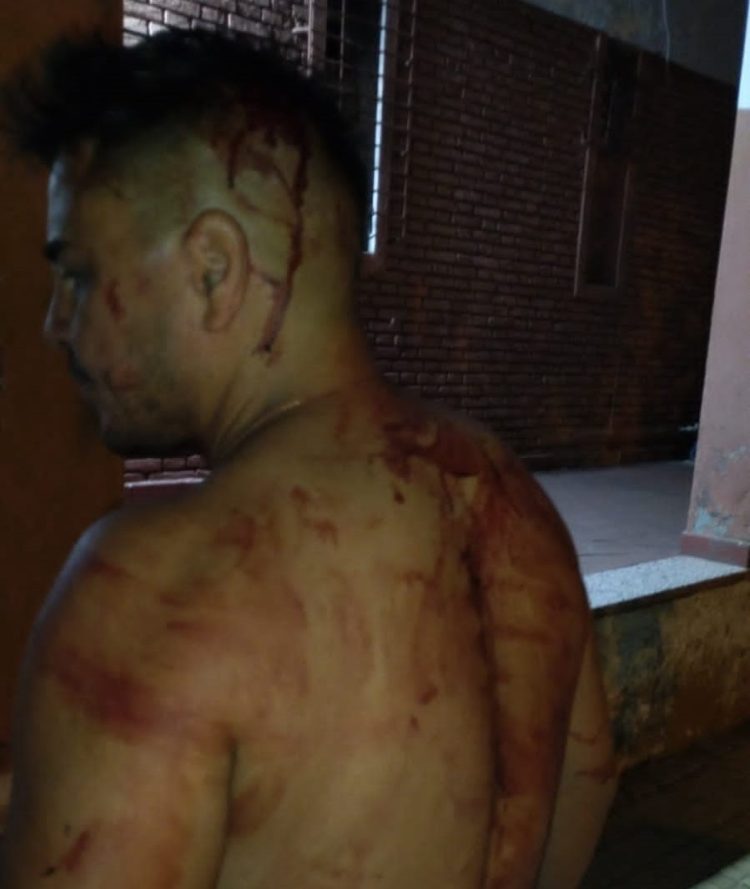 Asaltos a mano armada y robos en Alberdi, un argentino-paraguayo con negocios en el C5, una de las víctimas