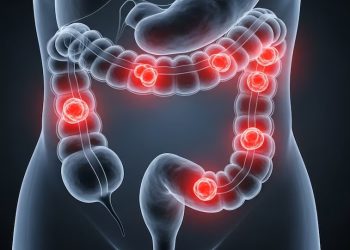 Científicos argentinos desarrollaron un virus que ataca el cáncer colorrectal y sus células resistentes