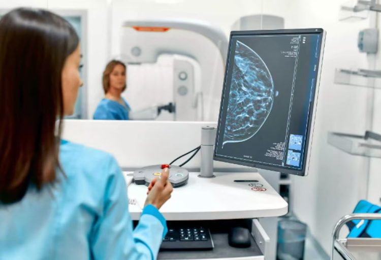 Cáncer de mama: cómo la detección temprana y el acceso rápido al tratamiento mejoran el pronóstico